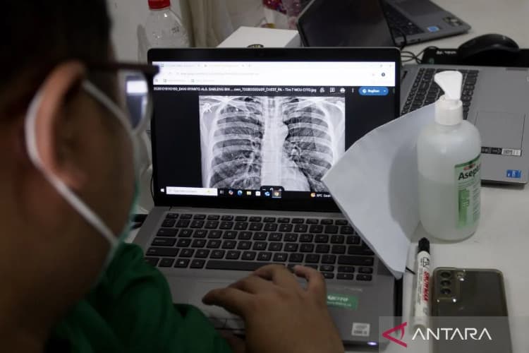 Batuk Tak Kunjung Sembuh, Dokter Ungkap Tanda Awal TBC pada Anak dan Dewasa